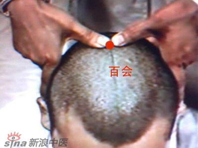艾灸常用的保健穴有哪些？--百會