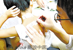 灸法的種類  你知道多少？