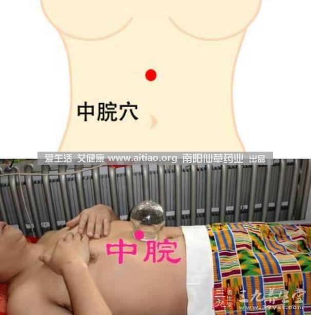 中脘穴位于腹部正中線，臍上4寸的位置上。每天艾灸10-15分鐘，能有效緩解胃部不適的癥狀，同時有助于祛濕。