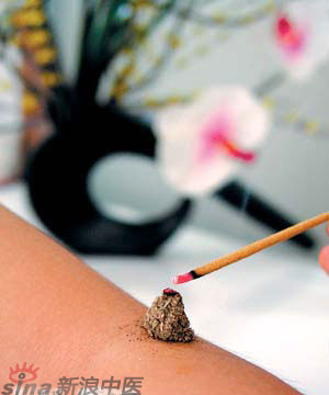 節(jié)氣灸” 冬至，你灸了嗎？